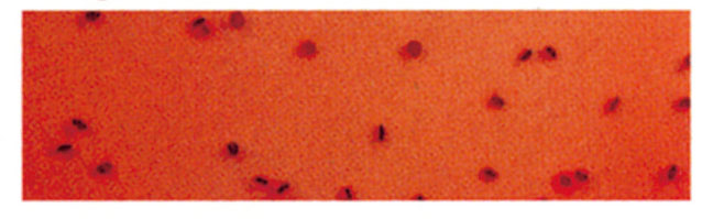 大腸菌（プラスチック板）